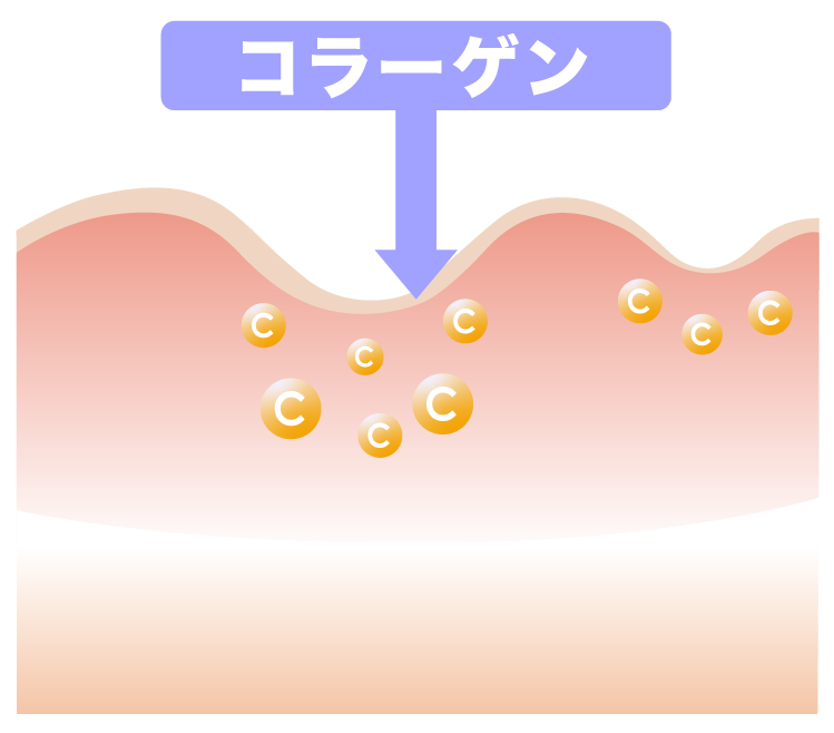 ダーマペン2