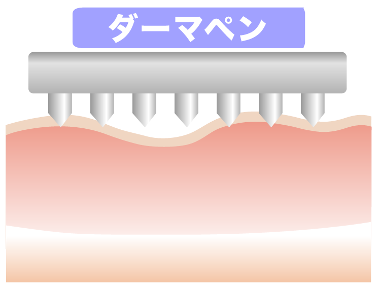 dc60bf0608eeb629a7ff9ef8be1bbd7b - 【Step'sプログラム】パンフレット